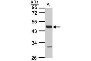 WB Image Sample(30 ug whole cell lysate) A:293T 10% SDS PAGE antibody diluted at 1:1000 (UST anticorps)