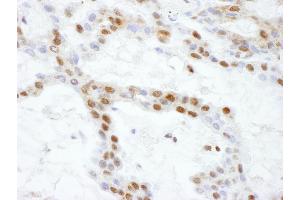 Immunohistochemistry (IHC) image for anti-Sjogren Syndrome Antigen B (SSB) (AA 50-100) antibody (ABIN7454499)