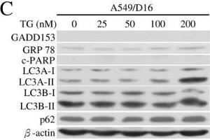 Analyses of GMI, TG and TM regulated ER stress, apoptosis and autophagy by Western blotting.