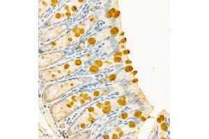 Immunohistochemistry of paraffin embedded mouse colon using CLCA1 (ABIN7073472) at dilution of 1:700 (400x lens) (CLCA1 anticorps)