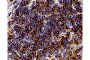 Immunohistochemistry analysis of paraffin-embedded Mouse spleen using CD192 Polyclonal Antibody at dilution of 1:300. (CCR2 anticorps)