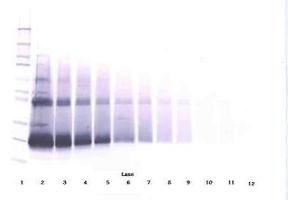 Image no. 3 for anti-Interferon, beta 1, Fibroblast (IFNB1) antibody (ABIN464941) (IFNB1 anticorps)