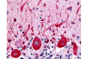 Anti-CELSR3 antibody IHC of human brain, Purkinje neurons.