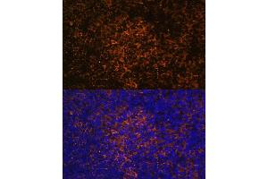 Immunofluorescence analysis of rat thymus using ICOS/CD278 antibody (ABIN3022590, ABIN3022591, ABIN3022592, ABIN1513055 and ABIN6218929) at dilution of 1:100. (ICOS anticorps  (AA 21-140))