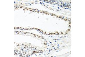 Immunohistochemistry of paraffin-embedded human prostate using ELAVL1 antibody.