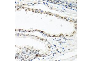 Immunohistochemistry of paraffin-embedded human prostate using ELAVL1 antibody. (ELAVL1 anticorps  (AA 1-100))