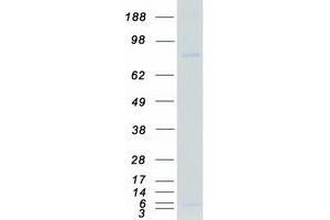 Validation with Western Blot