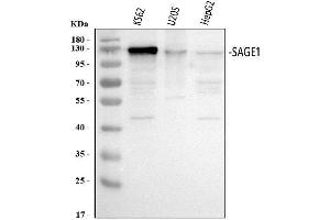 Western blot analysis of SAGE1 using anti-SAGE1 antibody (ABIN7602679). (SAGE1 anticorps  (AA 94-633))