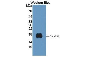 Western Blotting (WB) image for anti-Sialic Acid Binding Ig-Like Lectin 10 (SIGLEC10) (AA 571-697) antibody (ABIN3201748) (SIGLEC10 anticorps  (AA 571-697))