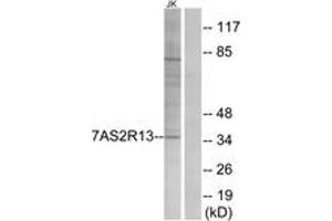 Western blot analysis of extracts from Jurkat cells, using TAS2R13 Antibody. (TAS2R13 anticorps  (AA 123-172))