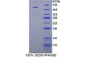 SDS-PAGE (SDS) image for Parathyroid Hormone (PTH) (AA 32-115) protein (His tag,MBP tag) (ABIN1879828)
