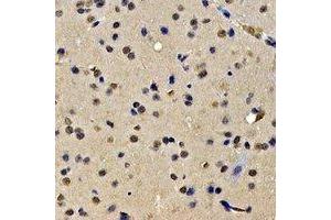 Immunohistochemical analysis of SKIV2L2 staining in rat brain formalin fixed paraffin embedded tissue section. (MTR4 anticorps)