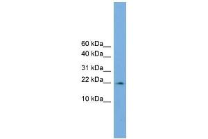 Human COLO205; WB Suggested Anti-PPIL3 Antibody Titration: 0. (PPIL3 anticorps  (Middle Region))