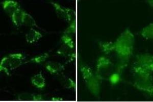 SY5Y cells were pretreated with 5nM bafilomycin for 24hr and fixed in methanol (left panel) or 4 % of paraformaldehyde (right panel).