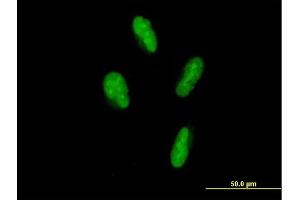 Immunofluorescence of purified MaxPab antibody to SP110 on HepG2 cell. (SP110 anticorps  (AA 1-547))