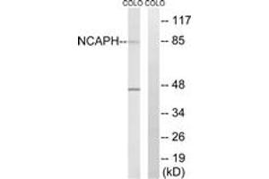 Western blot analysis of extracts from COLO cells, using NCAPH Antibody. (NCAPH anticorps  (AA 441-490))