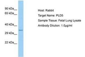 Image no. 1 for anti-Phospholipase D Family, Member 5 (PLD5) (AA 189-238) antibody (ABIN6750223) (PLD5 anticorps  (AA 189-238))
