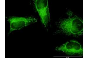 Immunofluorescence of monoclonal antibody to GSDMB on HeLa cell.