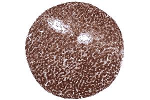 Strong nuclear and cytoplasmic arginase 1 expression in all hepatocytes in a normal liver