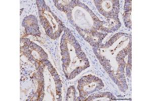 IHC analysis of Claudin 3/CLDN3 using anti-Claudin 3/CLDN3 antibody (ABIN7599625). (Claudin 3 anticorps  (AA 101-220))