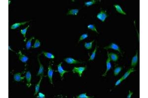 Immunofluorescent analysis of Hela cells using ABIN7167262 at dilution of 1:100 and Alexa Fluor 488-congugated AffiniPure Goat Anti-Rabbit IgG(H+L) (RAB25 anticorps  (AA 1-210))