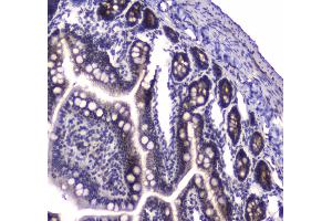 IHC analysis of PARN using anti-PARN antibody . (PARN anticorps  (AA 1-301))