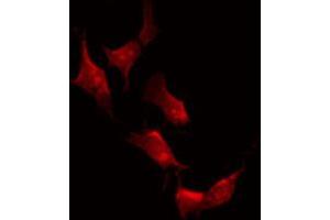 ABIN6267475 staining A2780 by IF/ICC.