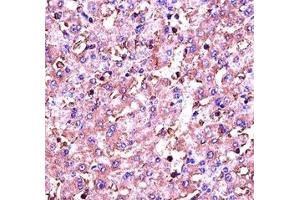 IGF1 antibody immunohistochemistry analysis in formalin fixed and paraffin embedded human liver tissue.