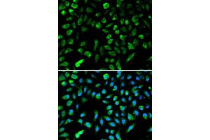 Immunofluorescence analysis of A549 cell using NME1 antibody. (NME1 anticorps  (C-Term))