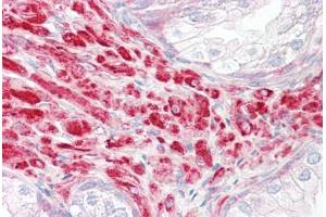 Image no. 2 for anti-Dickkopf 2 Homolog (DKK2) (AA 124-173) antibody (ABIN6749760)