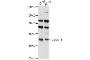 Western blot analysis of extracts of various cell lines, using B3GNT5 antibody (ABIN6293241) at 1:3000 dilution.