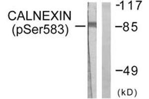 Western blot analysis of extracts from HeLa cells treated with EGF 200ng/ml 30', using Calnexin (Phospho-Ser583) Antibody. (Calnexin anticorps  (pSer583))