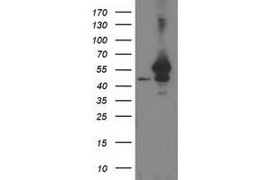 Western Blotting (WB) image for anti-ADP-Ribosylation Factor GTPase Activating Protein 1 (ARFGAP1) antibody (ABIN1496682) (ARFGAP1 anticorps)