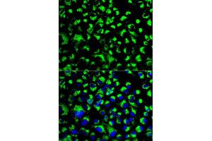 Immunofluorescence analysis of U2OS cell using HSPA9 antibody.