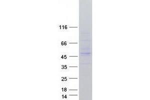 Validation with Western Blot