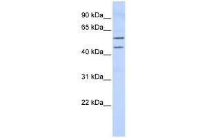 WB Suggested Anti-TBX22 Antibody Titration:  0. (T-Box 22 anticorps  (Middle Region))