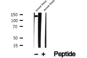 Western blot analysis of extracts of mouse brain tissue, using TRAPPC9 antibody.