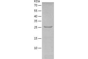 Western Blotting (WB) image for Dickkopf Homolog 1 (DKK1) (AA 1-272) protein (His tag) (ABIN7122660) (DKK1 Protein (AA 1-272) (His tag))