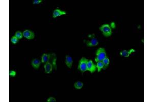 Immunofluorescence staining of MCF-7 cells with ABIN7151929 at 1:133, counter-stained with DAPI. (EMP2 anticorps  (AA 22-66))