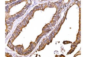 IHC analysis of ATP1B1 using anti-ATP1B1 antibody (ABIN7602014).