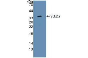 Detection of Recombinant ATF1, Mouse using Polyclonal Antibody to Activating Transcription Factor 1 (ATF1) (AFT1 anticorps  (AA 3-245))
