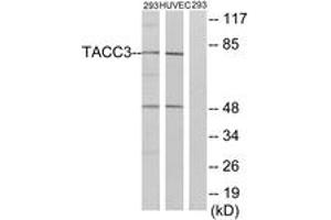 Western blot analysis of extracts from 293/HuvEc cells, using TACC3 Antibody.