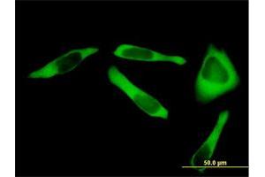 Immunofluorescence of purified MaxPab antibody to RARS on HeLa cell.