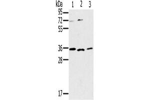 Western Blotting (WB) image for anti-Interleukin 22 Receptor, alpha 2 (IL22RA2) antibody (ABIN2430301)