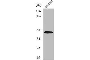 Western Blot analysis of COLO205 cells using PKR1 Polyclonal Antibody