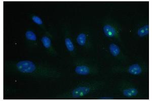 IF analysis of PARN using anti-PARN antibody (ABIN6719422). (PARN anticorps  (AA 1-301))