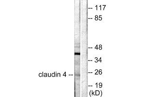 Western blot analysis of extracts from HeLa cells, using Claudin 4 antibody (ABIN5976355).