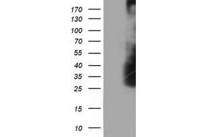 Western Blotting (WB) image for anti-Low Density Lipoprotein Receptor Adaptor Protein 1 (LDLRAP1) antibody (ABIN1496692) (LDLRAP1 anticorps)