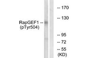 Western blot analysis of extracts from HepG2 cells treated with Na3VO4 0.