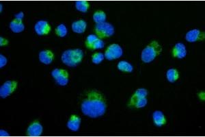 IF analysis of TIMM29 using anti-TIMM29 antibody (ABIN7601495). (TIMM29 anticorps  (AA 37-260))